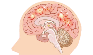 代償部の修復力を活性化させること