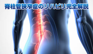 脊柱管狭窄症のリハビリ完全解説