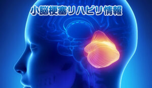 小脳梗塞リハビリ情報